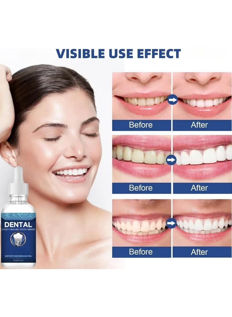 أورالحوي درع الأسنان لعلاج تجاويف الأسنان، جل إصلاح الأسنان، إصلاح اللثة ل receding gums، إصلاح الأسنان المتسوسة، درع دنتيت للأسنان، سائل درع الأسنان لعلاج التجاويف، إصلاح اللثة، علاج اللثة المتراجعة 60 مل - Image 2