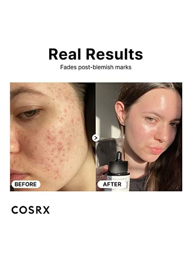 COSRX The Niacinamide 15 Serum 20ml - Image 3