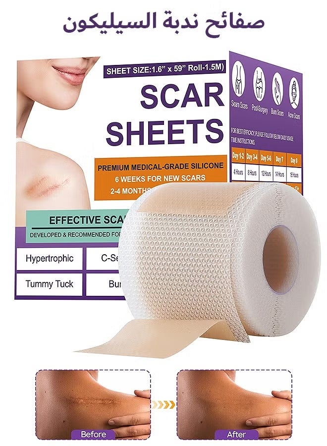 CARVENCHY Silicone Scar Tape, Silicone Scar Removal Sheets For Surgical, Reduces Keloid Visibility For Surgical C-Section Tummy Tuck Keloid Scars - Image 1