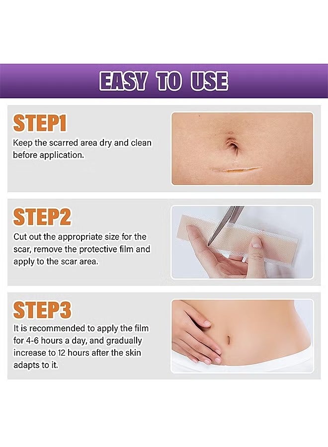 CARVENCHY Silicone Scar Tape, Silicone Scar Removal Sheets For Surgical, Reduces Keloid Visibility For Surgical C-Section Tummy Tuck Keloid Scars - Image 5