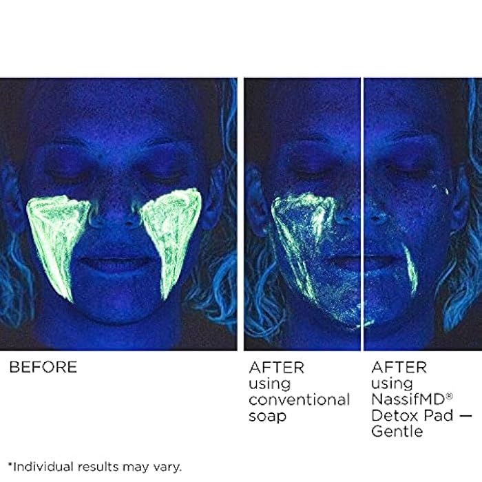NassifMD Gentle Detox Pads, Surgeon-Created Fruit Acid Complex for Sensitive Skin, Brightens, Exfoliates & Reduces Wrinkles, Dermatologist-Tested - Image 5