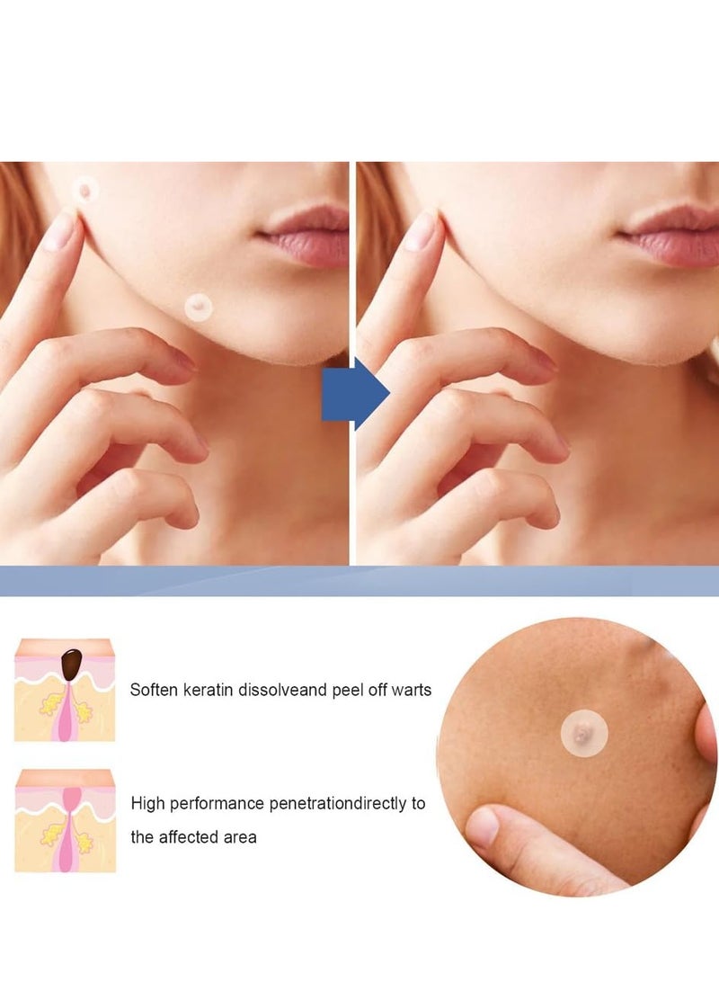 EELHOE 144PCS Wart Removal Patches, Natural Wart Remover Plasters, Mole and Skin Tag Removal Pads, Pain-Free Wart Treatment for Hands, Face, and Body - Image 2
