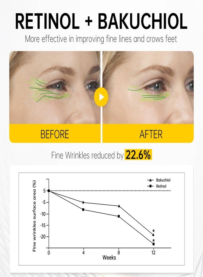 VGO Retinol Eye Cream, Anti-Aging Eye Cream for Dark Circles & Puffiness with 1% Retinol, 1% Bakuchiol & 6% Caffeine to Reduce Wrinkles, Fine Lines, De-puff and Eye Bags, 0.52 oz/15g, Made in USA - Image 3