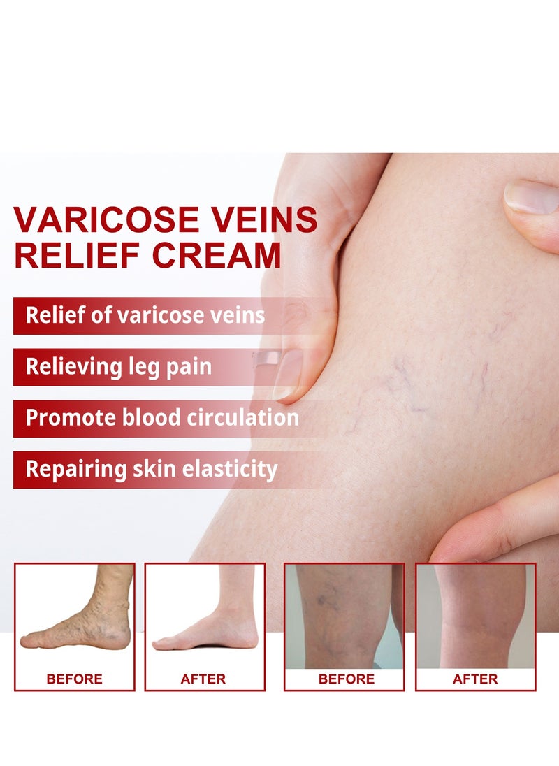 SOUTH MOON - South Moon Vein Repair Cream Massage Varicose Relief Cream - Image 1