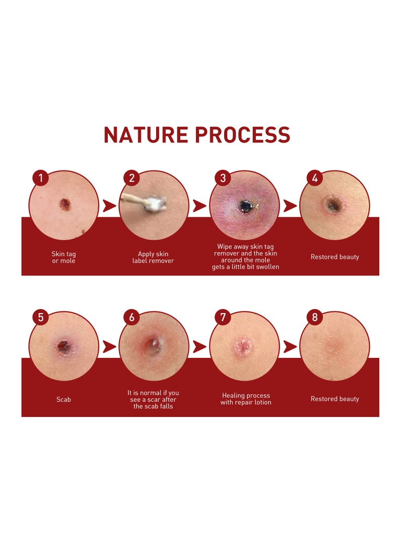 EELHOE Organic Skin Solutions Serum for Lighten Skin Moles and Eliminate Warts  - Image 5