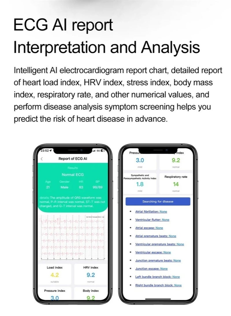 AROAQ Smart Watch with 1.43 Inch AMOLED Display for Blood Sugar Lipid and Uric Acid Monitoring Sports Tracking ECG PPG HD Bluetooth Calling AI Voice Assistant and SOS Feature - Image 3