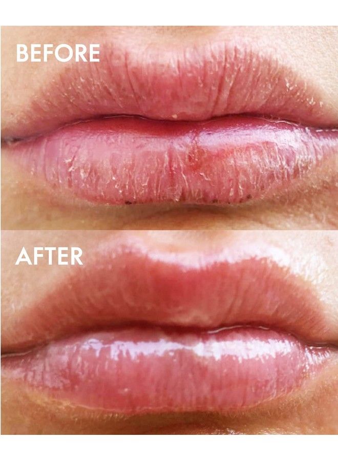 Lanolips 101 Ointment Fruities Trio Set Of 3 Lip Balms In Natural Strawberry Peach And Green Apple Skincare Gift Set For Her Clean Crueltyfree (10G / 035Oz Each) - Image 3