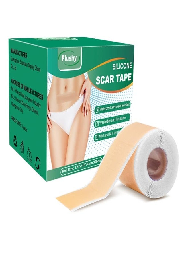 Silicone Scar Sheets, Self-Adhesive Scar Tape, Silicone Sheets For Scars, Scar Tape For Surgical Scars, Keloid Bump Removal, Cesarean Surgery Scar Removal(1.6"x 118" Roll) - Image 1