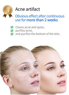 KinseiBeauty Acne Treatment  Plasma Beauty Equipment  - Image 4