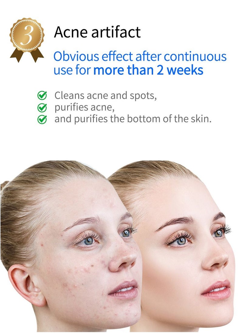 كينسي بيوتي معدات التجميل بالبلازما لعلاج حب الشباب  - Image 4
