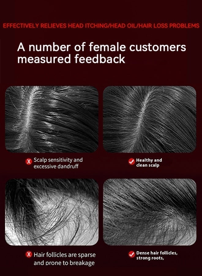 فرشاة شعر، أداة توزيع زيت فروة الرأس، قابلة لإعادة الشحن، تدليك اهتزازي، مقاومة للماء IPX7، مشط تدليك عميق للرأس محمول لنمو الشعر واسترخاء الرأس، مدلك مضاد لتساقط الشعر - Image 4