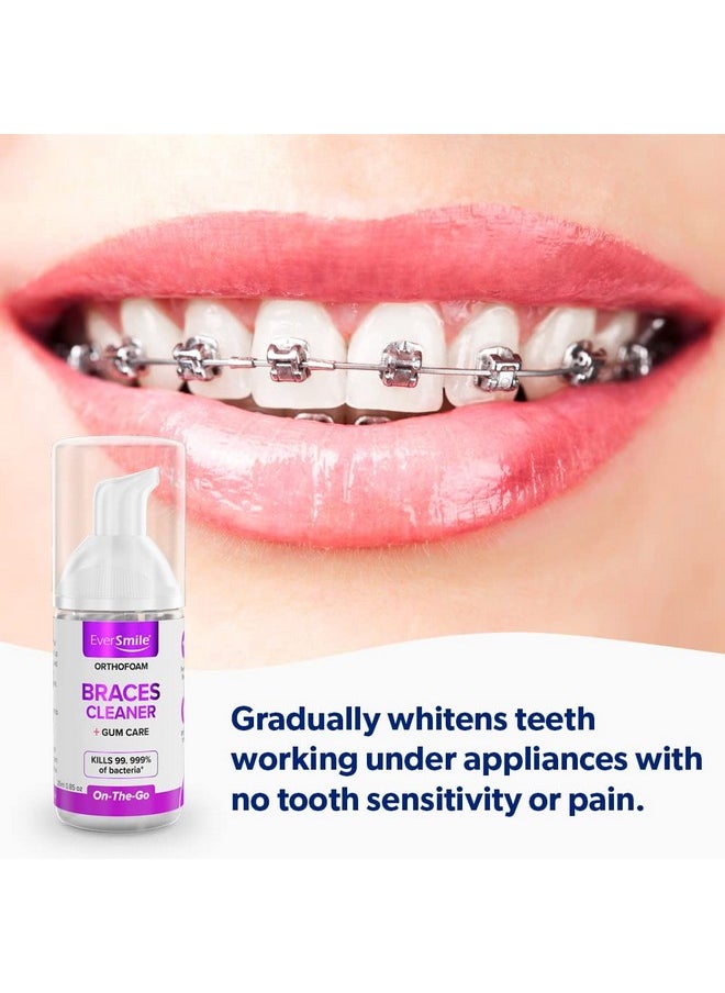EverSmile OrthoFoam Braces Cleaner - Cleans Under Metal, Ceramic or Clear Brackets & Wires. Can Brush or Rinse with & Use in Trays. Foaming Bubbles Whiten Teeth & Fight Plaque (1 Pack - 25 ml)  - Image 5