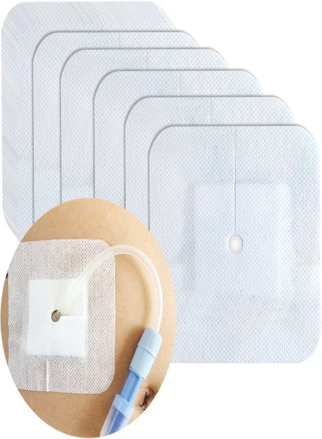 DiaBelt Drain Split Bordered Gauze Island Dressing Pad for Peritoneal Dialysis PD Catheter Stomach Feeding Peg J Tube| Individually Packed| Wound Bandage with Adhesive Border (4 x 4 Inch (Pack of 40 - Image 1