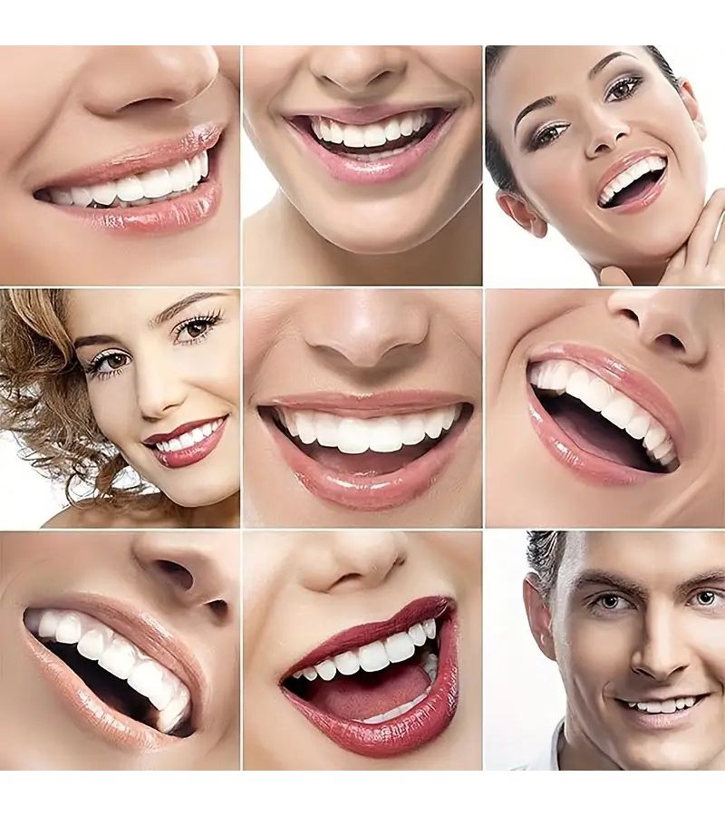 White Teeth Veneers Premium Edition Unisex Upper Lower Dental Set - Image 2