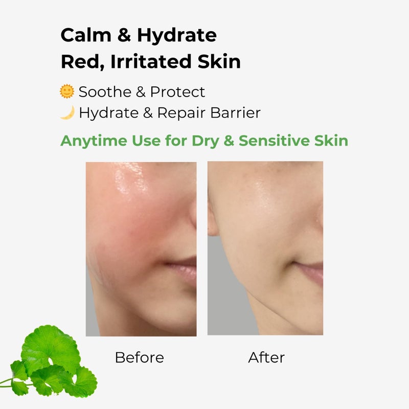 BMBCO The Cica Serum â€“ Calming & Balancing Ampoule for Sensitive Skin | Vegan Korean Skincare with Tiger Grass â€“ 30ml / 1.01 fl oz - Image 3