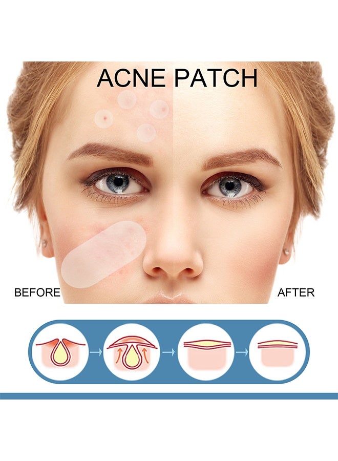 EELHOE Acne Patch Large Pimple Patches -Big Acne Patches, XL Hydrocolloid Bandages for Full Face, Forehead, Chin, Nose, Body, Back, Neck & Chest, Oval, Moon, Square hydrocolloid Patch ( 80 Patches) - Image 5