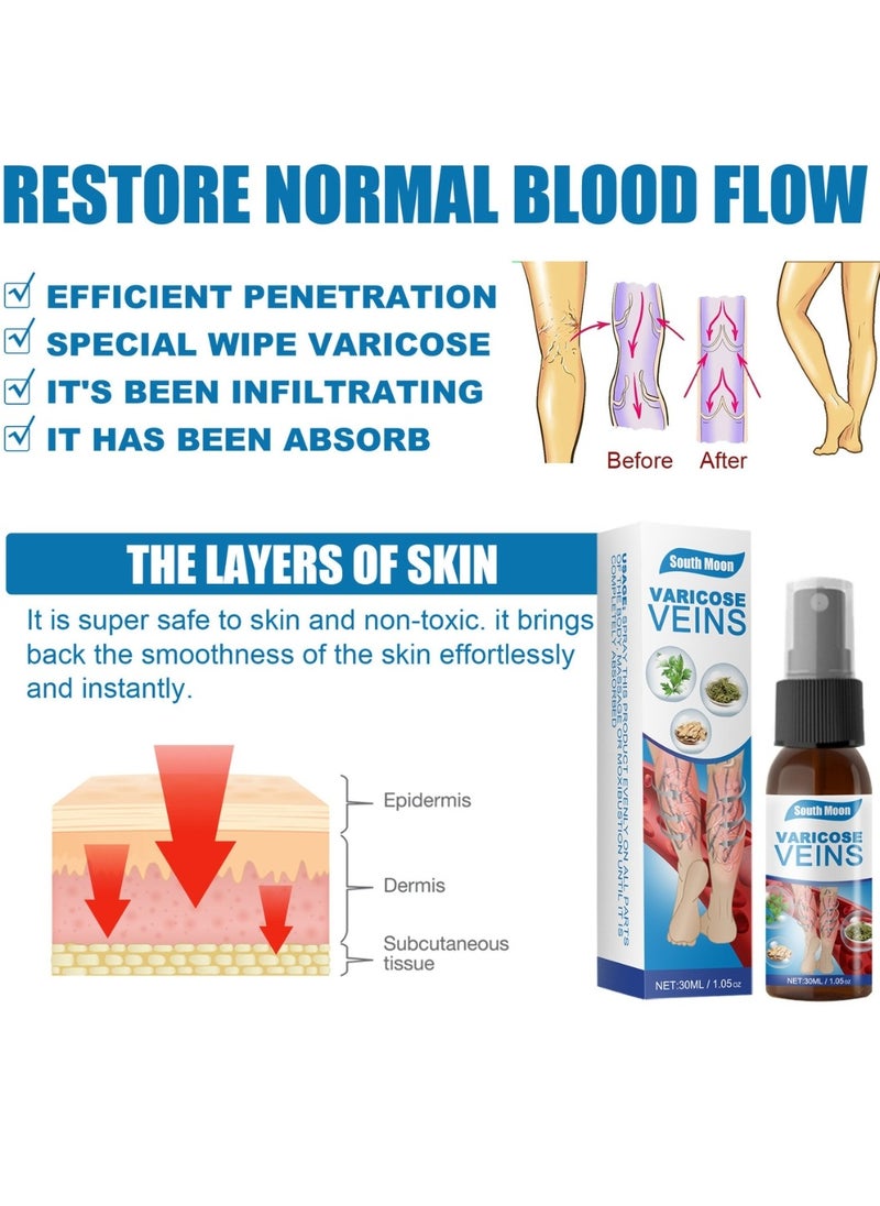 SOUTH MOON - Varicose Veins Treatment Spray Vein Healing Varicose Veins Spray Varicose Veins Oil for Legs Varicose Veins Miracle Spray Improve Blood Circulation Varicose Vein Repair Cream 30ml - Image 1