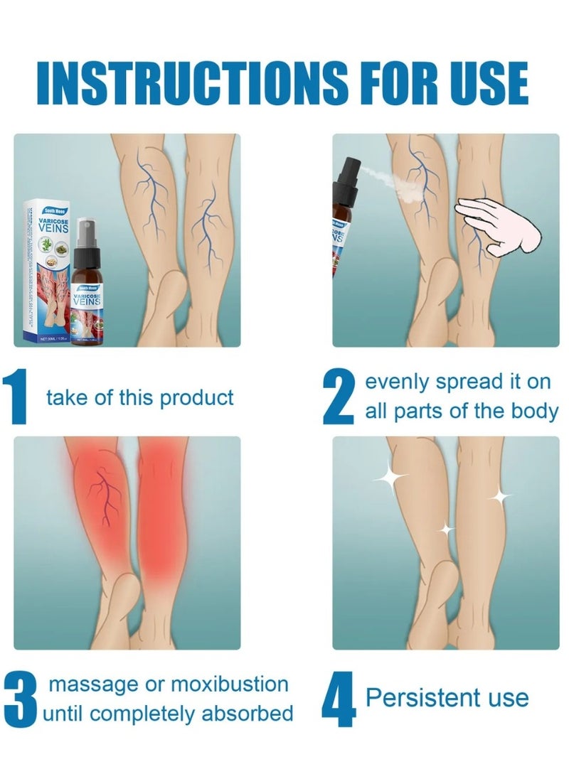 SOUTH MOON - Varicose Veins Treatment Spray Vein Healing Varicose Veins Spray Varicose Veins Oil for Legs Varicose Veins Miracle Spray Improve Blood Circulation Varicose Vein Repair Cream 30ml - Image 1