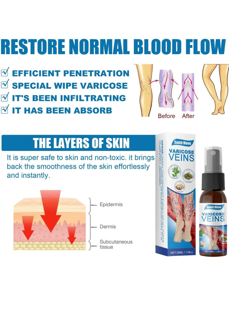 SOUTH MOON - Varicose Veins Treatment Spray Vein Healing Varicose Veins Spray Varicose Veins Oil for Legs Varicose Veins Miracle Spray Improve Blood Circulation Varicose Vein Repair Cream 30ml - Image 1