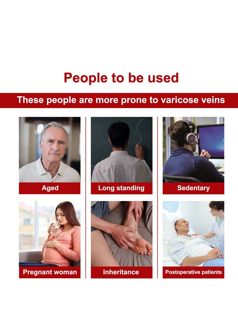 SOUTH MOON Varicose Veins Cream, Varicose Veins Cream Against Varicose Veins and Spider Veins, Algae Ointment Varicose Veins Cream for Legs, Varicose Veins Treatment for Legs, Remove Varicose Veins 20g - Image 2