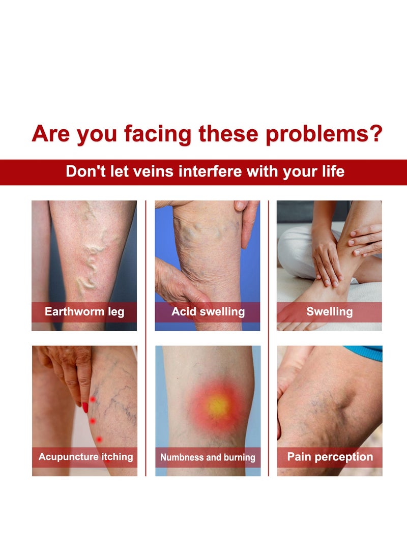 SOUTH MOON Varicose Veins Cream, Varicose Veins Cream Against Varicose Veins and Spider Veins, Algae Ointment Varicose Veins Cream for Legs, Varicose Veins Treatment for Legs, Remove Varicose Veins 20g - Image 3