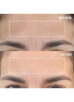 WRINKLES SCHMINKLES Wrinkles Schminkles Forehead & Under Eye Wrinkle Set - Reusable Silicone Patches for Smoothing Facial Lines - Overnight Wrinkle Reduction (1 Pair)  - Image 3