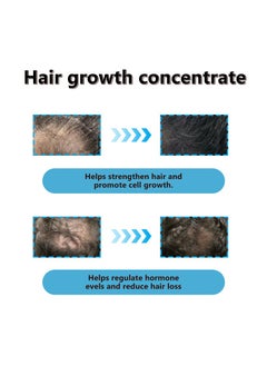 Hair Growth Co Hair Growth Serum Concentrate - 3% Redensyl, 4% Anagain, 2% Baicapil, Caffeine, Biotin & Rice Water - Rosemary Hair Serum for Hair Fall Control & Hair Growth 30ml  - Image 3