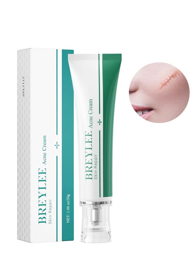 Breylee Acne Scar Removal Cream Skin Repair Skin Care Scar Acne Treatment Remove Stretch Marks Whitening Cream - Image 1