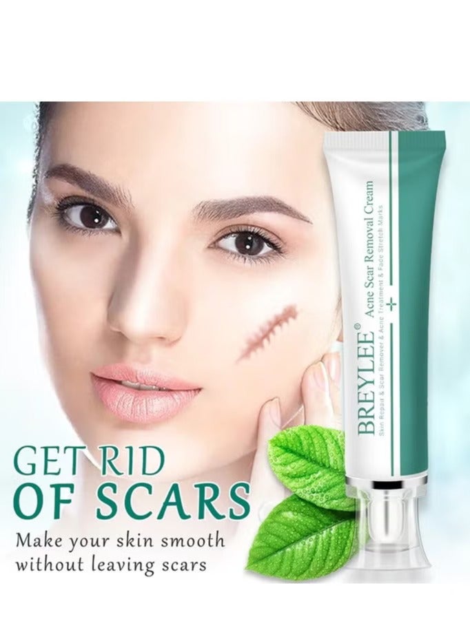 Breylee Acne Scar Removal Cream Skin Repair Skin Care Scar Acne Treatment Remove Stretch Marks Whitening Cream - Image 2