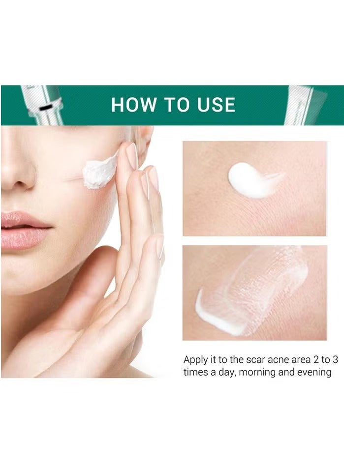 Breylee Acne Scar Removal Cream Skin Repair Skin Care Scar Acne Treatment Remove Stretch Marks Whitening Cream - Image 4