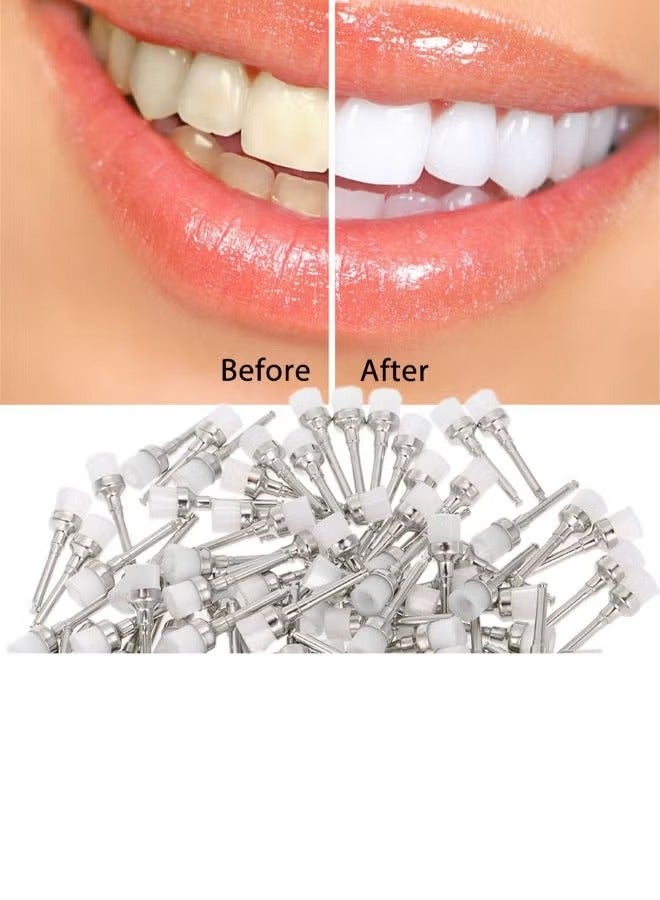 مجموعة فرشاة الأسنان بروفاي مكونة من 100 قطعة باللون الفضي/الأبيض 0.16 كجم - Image 2