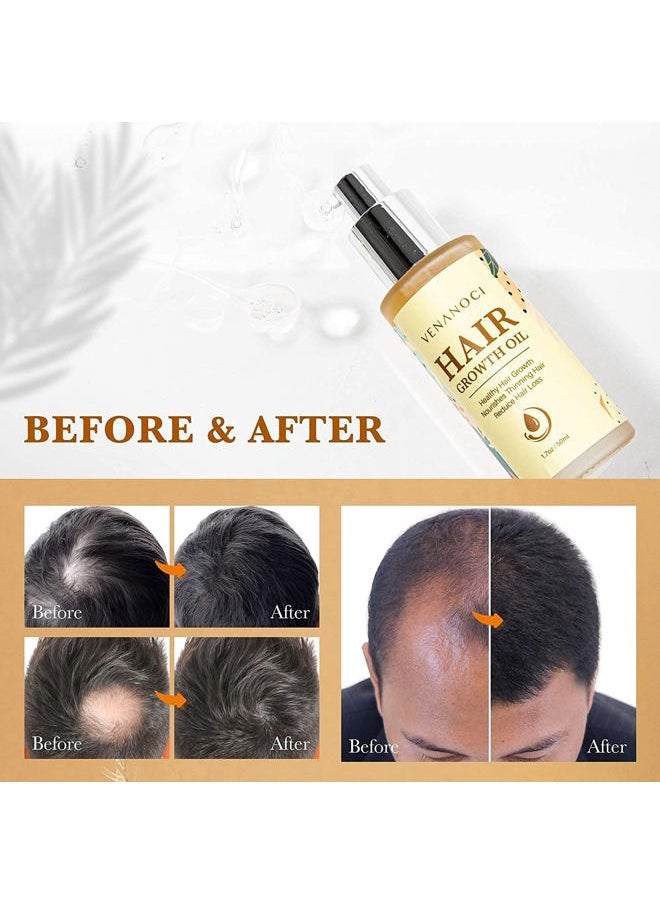 Venanoci - Biotin, Castor & Rosemary Oil for Hair Growth for Women, hair loss treatments for dry damaged hair and growth, Serum for Thicker Longer Fuller Healthier Hair, All Natural Vitamin Rich Treatment - Image 1