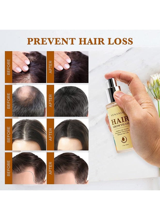 Venanoci - Biotin, Castor & Rosemary Oil for Hair Growth for Women, hair loss treatments for dry damaged hair and growth, Serum for Thicker Longer Fuller Healthier Hair, All Natural Vitamin Rich Treatment - Image 1