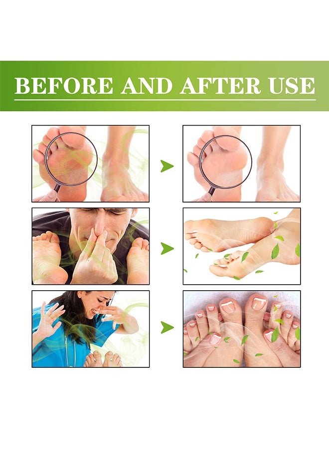 SOUTH MOON - Foot Deodorant Spray, Foot Odor Eliminator for Stinky Feet, Foot Sweat Foot Odor Freshener - Image 1