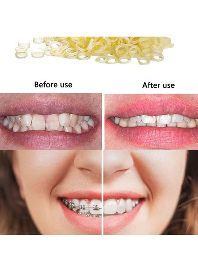 HY 500 Pcs Orthodontic Elastic Rubber Bands, 4.5 Oz 1/4" Size Dental Rubber Traction Bands for Teeth Gap, Braces, Dog Grooming Top Knots, Bows, Braids, Tooth Gaps, and Dreadlocks  - Image 4