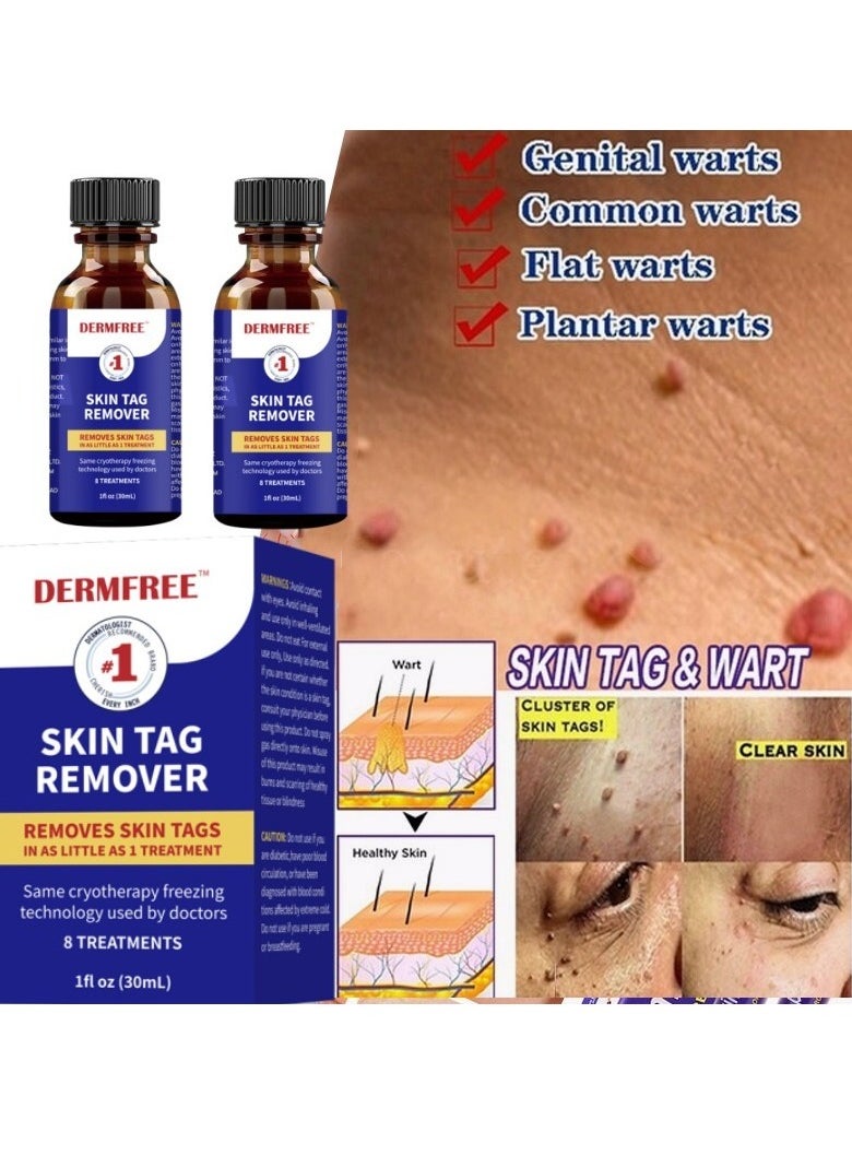 DERMFREE مزيل علامات الجلد يزيل علامات الجلد وعلامات الشامات والشامات، إزالة سريعة وآمنة للوجه والجسم، مصل إزالة علامات الجلد بقوة إضافية، سهل الاستخدام، مجموعة إزالة علامات الجلد 30 مل  - Image 2