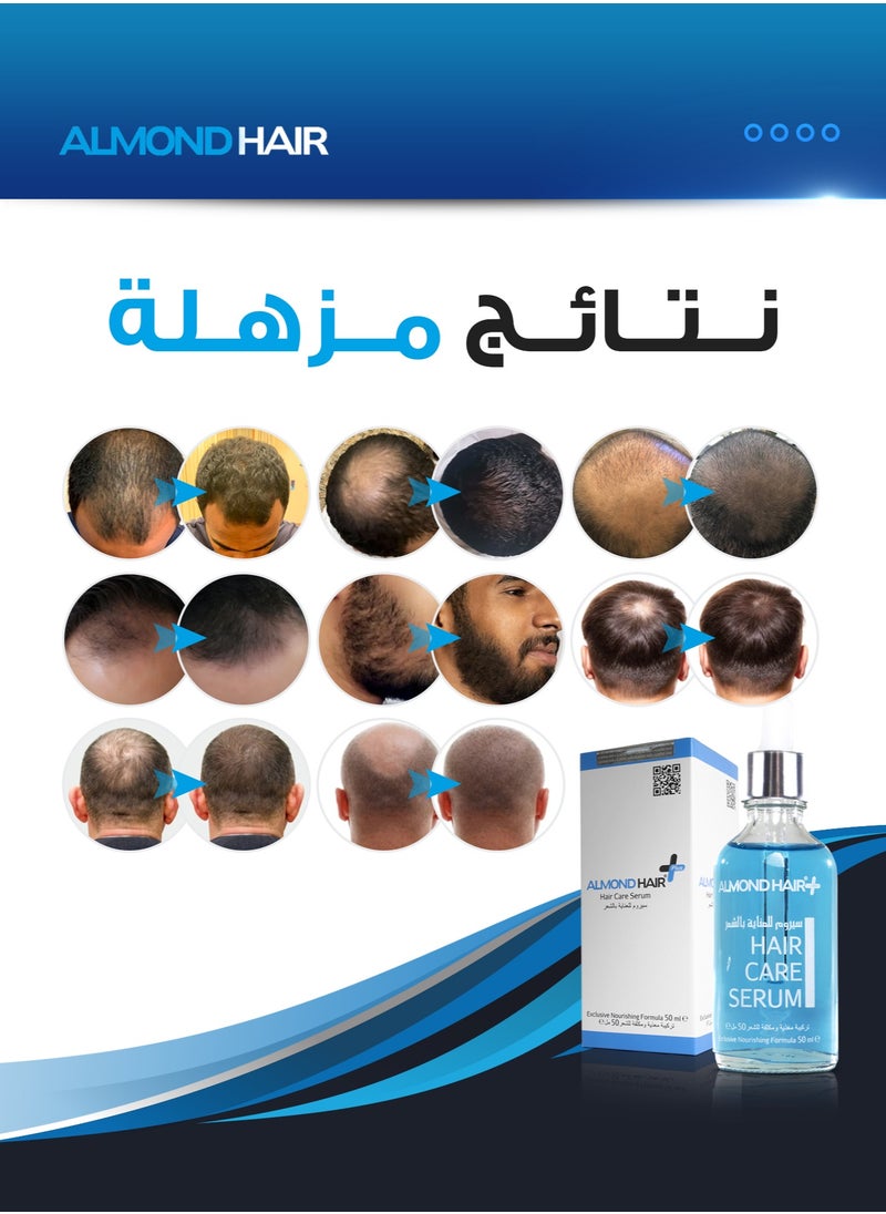 Hair Care Serum with Capilia Longa for Men - pzsku/Z09D6B51E1517BD2506A3Z/45/_/1725833513/65ccb305-32d1-4ff4-8596-b303c7e870c0
