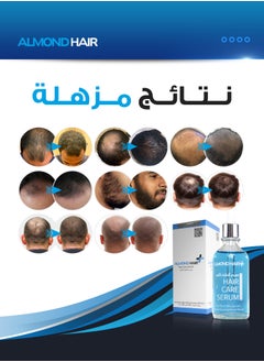 الموند هير سيروم الموند هير بلس مع كابيليا لونجا للعناية بالشعر للرجال  - Image 3