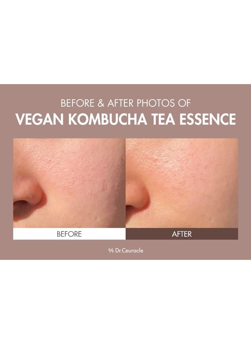 Dr.Ceuracle Vegan Kombucha Tea Essence - 150mL  - Image 3