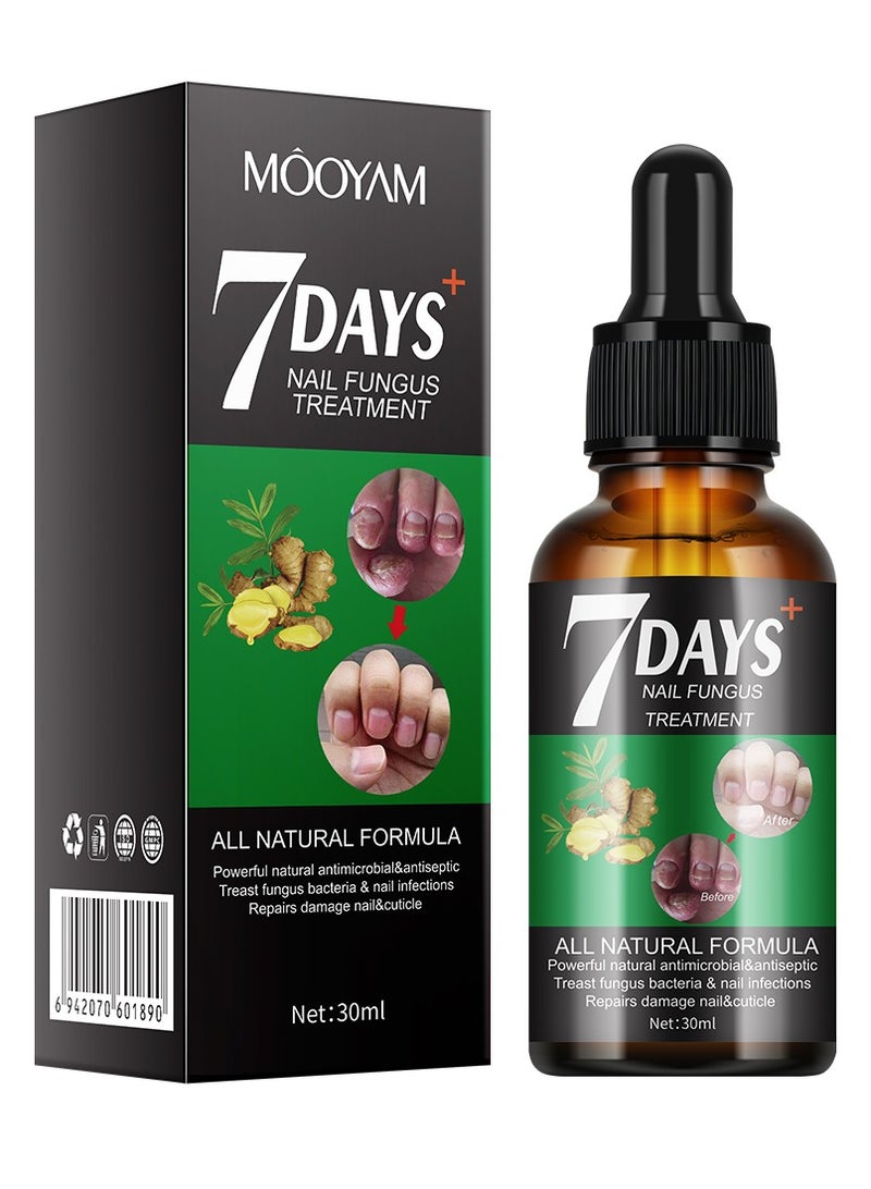 موويام 7 أيام علاج الفطر، ترطيب البشرة وتعزيز الأظافر ومساعدة الأظافر النمو الصحي إصلاح الأظافر حل العلاج استعادة الأظافر الصحية 30 مل - Image 1