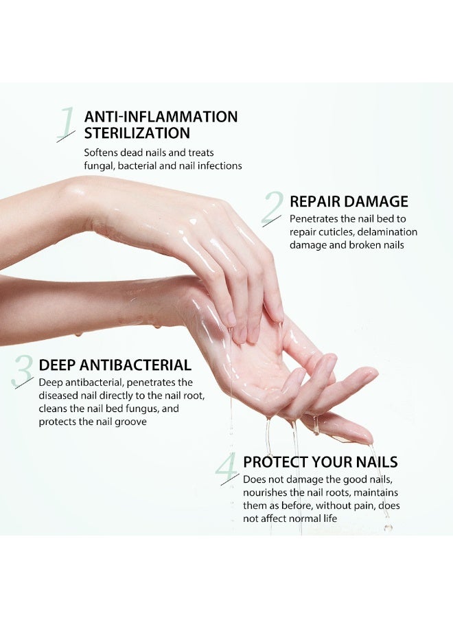 موويام 7 أيام علاج الفطر، ترطيب البشرة وتعزيز الأظافر ومساعدة الأظافر النمو الصحي إصلاح الأظافر حل العلاج استعادة الأظافر الصحية 30 مل - Image 3