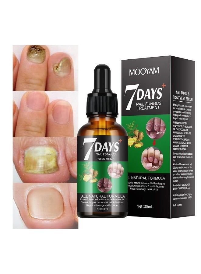 MOOYAM 7 Days Nails Fungus Treatment, Moisturize the Cuticle & Strengthen Nails and Helps Nails Healthy Grow Nail Repair Treatment Solution Restoring Healthy Nails 30ml - Image 1