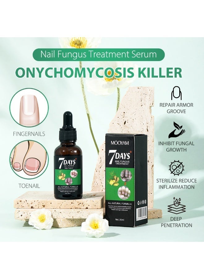 MOOYAM 7 Days Nails Fungus Treatment, Moisturize the Cuticle & Strengthen Nails and Helps Nails Healthy Grow Nail Repair Treatment Solution Restoring Healthy Nails 30ml - Image 4