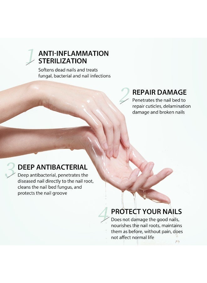 MOOYAM 7 Days Nails Fungus Treatment, Moisturize the Cuticle & Strengthen Nails and Helps Nails Healthy Grow Nail Repair Treatment Solution Restoring Healthy Nails 30ml - Image 3