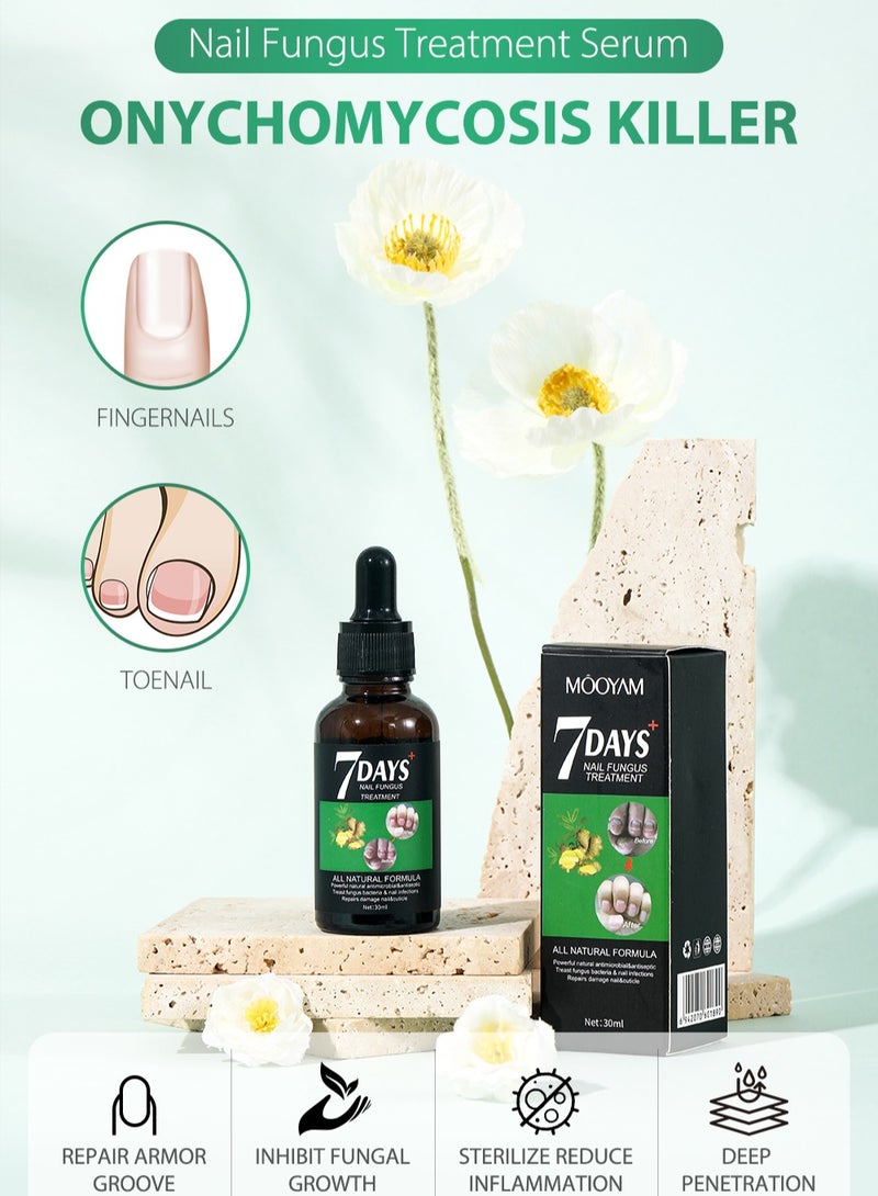 MOOYAM 7 Days Nails Fungus Treatment, Moisturize the Cuticle & Strengthen Nails and Helps Nails Healthy Grow Nail Repair Treatment Solution Restoring Healthy Nails 30ml - Image 2
