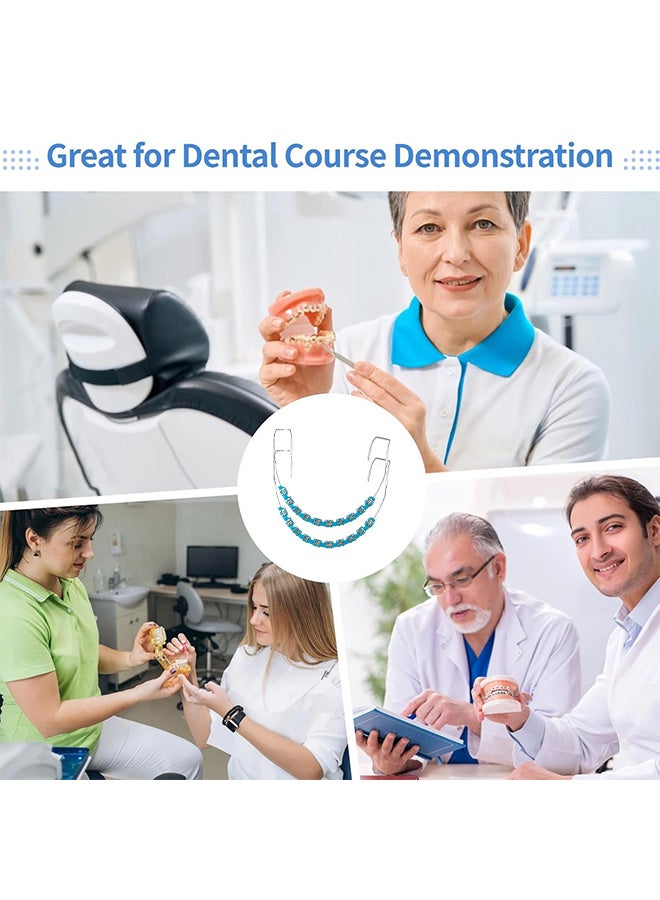 Depend Metal Braces For Orthodontics, Metal Bracket And Orthodontic Ligature Ties, Props For Dental Students Orthodontic Practice To Practice - Blue - Image 5