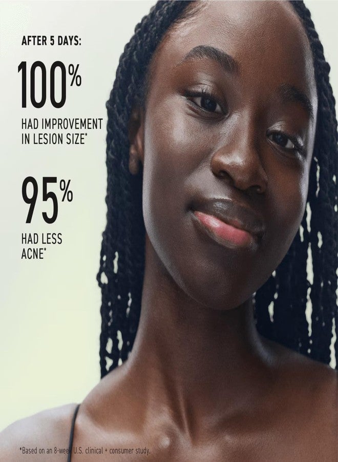 Rodan Fields Rodan + Fields Spotless Regimen | Benzoyl Peroxide Face Wash for Sensitive Skin | Skincare Sets & Kits | Skin Care for Adults & Teens with Stubborn Acne | All Skin Types - Image 3
