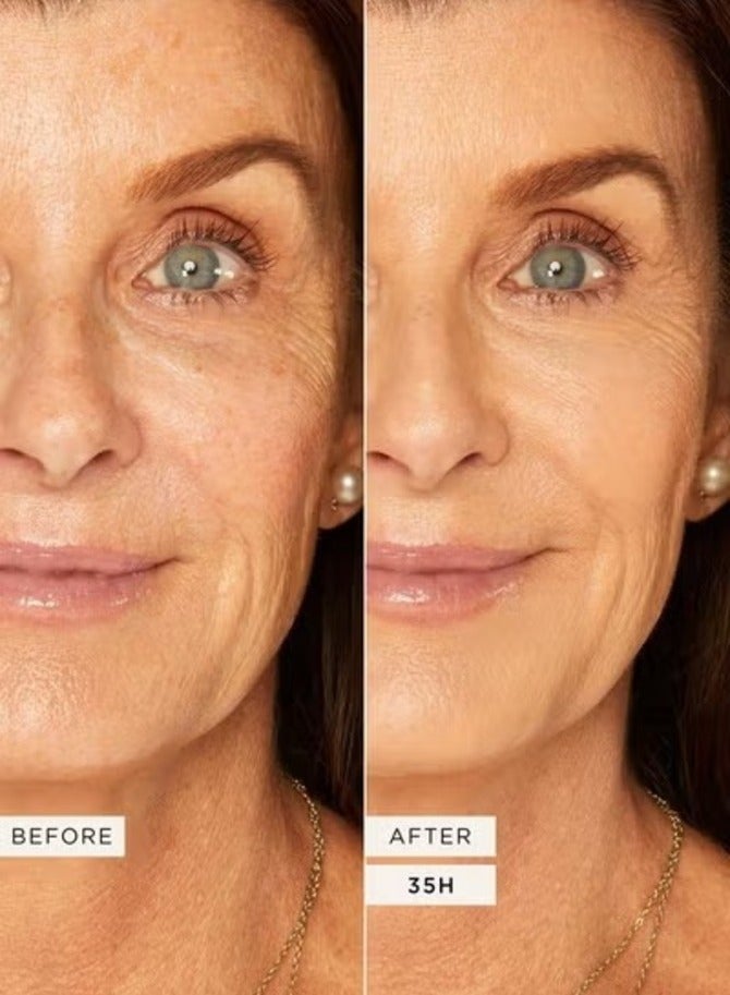 Tarte Cosmetics Shape Tape Ultra Creamy Concealer (35H medium honey + Net 10 ML / 0.33 Fl. Oz.) - Image 2