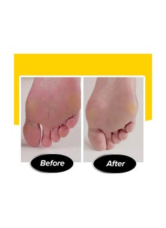 Generic Callus Remover Ped Egg  - Image 4