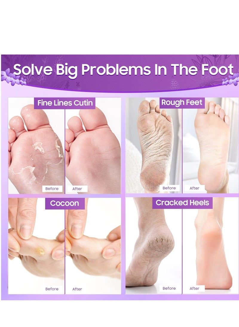 Excefore Foot Peel Mask, 2 Pack Foot Masks Exfoliating, Natural Exfoliator for Dry Dead Skin, Callus, Repair Rough Heels, More Healthy Foot Care for Men Women - Image 4